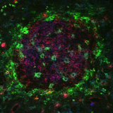 <h5>Anje te Velde</h5><p>Follikel in de darm van een patiënt met colitis ulcerosa. CD11c groen, CD83 rood, CD80 blauw.</p>