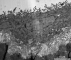 <h5>Bas ten Harkel</h5><p>Transmission electron microscopy of an osteoclast. An osteoclast with ruffled border on a bone slice. The osteoclast created a resorption pit by resorbing the bone. Scale bar = 5 µm.

For electron microscopic analysis ultrathin sections of the bone slices were collected on formvar-coated grids and counterstained with uranyl acetate and lead citrate. Images were acquired using a FEI Technai 12 transmission electron microscope.</p>