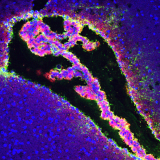 <h5>Beatrice Bedussi</h5><p>Ventricle and choroid plexus of a mouse brain. Tracers (green and red) coming from the brain parenchyma reached the ventricle, crossing the ependymal layer. Red tracer is taken up by the choroid plexus while the green one stays on its outer layer. It highlights a possible double role of the choroid plexus: firstly production of CSF, and secondly a possible clearing function for waste product in the brain. Blue: nuclear stain.</p>