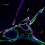 <h5>Beatrice Bedussi</h5><p>Penetration of tracer (green) into a rat brain along a newly discovered pathway alongside blood vessels. Pink: laminin stain. Blue: nuclear stain.</p>