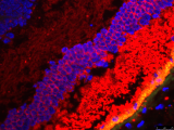 <h5>Celine Koster</h5><p>Dit is een cryosection van een humane retina en dan aangekleurd met Rhodopsine antibody.
Het secundaire antibody is een Goat anti Mouse – Cy3.
De retina heeft autofluorescentie in het FITC kanaal, vandaar de groene kleur van het RPE en Bruch’s  Membraan.
Verder is DAPI gebruikt voor het kleuren van de celkernen.</p>