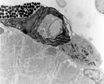 <h5>Hans Janssen</h5><p>Dit is net onder de huid van een zebravis de cellen die de zebrastrepen vormen. Linksboven een melanophore voor de zwarte strepen, in het midden een iridophore (licht reflecterende cel) voor de zilveren strepen. De kristallen reflecteren het licht als spiegels.
From Wikipedia: Iridophores, sometimes also called guanophores, are pigment cells that reflect light using plates of crystalline chemochromes made from guanine.[9] When illuminated they generate iridescent colours because of the diffraction of light within the stacked plates. Orientation of the schemochrome determines the nature of the colour observed.</p>