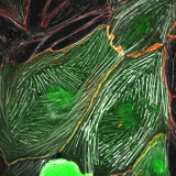 <h5>Jeffrey Kroon</h5><p>Human Umbilical Vein Endothelial Cells (HUVECs) are adenovirally transduced with GFP-tagged Trio (as shown in green). Trio is a guanine nucleotide exchange factor (GEF) for the small GTpases Rac1 and RhoG. These GTPases are in turn involved in remodeling of the actin cytoskeleton (shown in white) and are involved in regulating junctional integrity (VE-cadherin,shown in red). In this image, over-expression of Trio (green) induces short and thick actin fibers (white) and stabilizes the VE-cadherin-based junctions (red).</p>