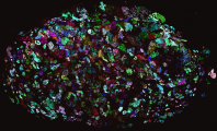 <h5>Maartje van der Heijden</h5><p>Each cell of a colorectal cancer cell line was marked with a different color. The cell line was then injected subcutaneously into mice in order to allow tumor growth. Next, the tumor was collected, sectioned and imaged by fluorescent microscopy. The image presents a section which shows the different clones that have contributed to the initiation and growth of the tumor.</p>