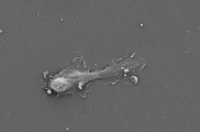 <h5>Marchien Dallinga</h5><p>SEM image of TIP Cell</p>