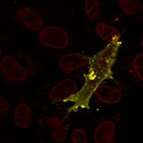 <h5>Marchien Dallinga</h5><p>Kleuring van een tip cel (CD34-groen) in een kweek van endotheelcellen. Met phalloidine (F-actin-rood) is het cytoskelet weergegeven.</p>