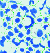 <h5>Maria Laura Ferrando</h5><p>3D confocal images of Caco-2 and IPEC-J2 cell layers stained for the TJ protein occludin (green) in the presence of S. suis 2 BM407 (red) after 4 h incubation. The nuclei of intestinal cells are stained with DAPI (blue).</p>