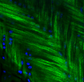 <h5>Samaneh Ghazanfari</h5><p>The sample shows the cross-aligned collagen structure of the intervertebral disc. It was stained with collagen I and Dapi.</p>