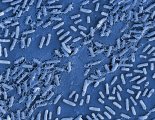 <h5>Tetyana Zakharkina</h5><p>This image represents Pseudomonas aeruginosa biofilm formed on the surface of the semi-permeable contact lens.  The biofilm was grown for three days and on the image single attached cells and extracellular matrix formation can be observed.</p>