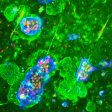 <h5>Teun de Vries</h5><p>Confocal imaging of osteoclasts. In order to prove that multinucleated osteoclasts are functional cells, one has to demonstrate that these cells degrade bone. Here, an experiment is shown where mouse osteoclasts were formed on bovine cortical bone slices. Live osteoclasts were incubated with FITC-labeled lactoferrin (green), nuclei were stained with propidium iodide (red), and cell surface of osteoclasts was stained with anti-CD44 (blue), labeled with Alexa-647. Projection.</p>