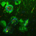<h5>Teun de Vries</h5><p>Confocal imaging of osteoclasts. In order to prove that multinucleated osteoclasts are functional cells, one has to demonstrate that these cells degrade bone. Here, an experiment is shown where mouse osteoclasts were formed on bovine cortical bone slices. Live osteoclasts were incubated with FITC-labeled lactoferrin (green), nuclei were stained with propidium iodide (red), and cell surface of osteoclasts was stained with anti-CD44 (blue), labeled with Alexa-647. Section B.</p>