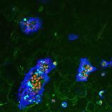 <h5>Teun de Vries</h5><p>Confocal imaging of osteoclasts. In order to prove that multinucleated osteoclasts are functional cells, one has to demonstrate that these cells degrade bone. Here, an experiment is shown where mouse osteoclasts were formed on bovine cortical bone slices. Live osteoclasts were incubated with FITC-labeled lactoferrin (green), nuclei were stained with propidium iodide (red), and cell surface of osteoclasts was stained with anti-CD44 (blue), labeled with Alexa-647. Section C.</p>