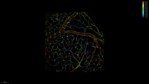 <h5>Anne-Eva van der Wijk</h5><p>Whole-mount staining of retina from an adult mouse. Retinal vasculature was stained with an isolectin B4 probe and image was recorded using the confocal laser scanning microscope SP8 with a 20x objective. (3D)</p>