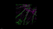 <h5>Anne-Eva van der Wijk</h5><p>Whole-mount staining of retina from a young mouse showing astrocytes wrapped tightly around the retinal vessels. Retinal vasculature was stained with an isolectin B4 probe and astrocytes with a rabbit-anti-GFAP antibody. Image was recorded using the confocal laser scanning microscope SP8 with a 40x objective. (3D)</p>