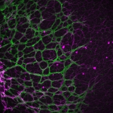 <h5>Anne-Eva van der Wijk</h5><p>Whole-mount staining of retina from a young mouse showing astrocytes wrapped tightly around the retinal vessels. Retinal vasculature was stained with an isolectin B4 probe and astrocytes with a rabbit-anti-GFAP antibody. Image was recorded using the confocal laser scanning microscope SP8 with a 40x objective</p>