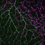 <h5>Anne-Eva van der Wijk</h5><p>Whole-mount staining of retina from a young mouse showing astrocytes wrapped tightly around the retinal vessels. Retinal vasculature was stained with an isolectin B4 probe and astrocytes with a rabbit-anti-GFAP antibody. Image was recorded using the confocal laser scanning microscope SP8 with a 40x objective.</p>