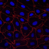 <h5>Anne-Eva van der Wijk</h5><p>Whole-mount staining of retina from an adult mouse. Retinal Claudin-5 expression in bovine retinal endothelial cells. Claudin-5, one of the key components of tight junctions, is expressed around the cell borders of endothelial cells. Cells were fixed with 75% ethanol, permeabilized and stained with anti-claudin-5 antibody. Image was recorded using the confocal laser scanning microscope SP8 with a 63x objective.</p>