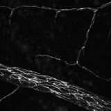 <h5>Anne-Eva van der Wijk</h5><p>Whole-mount staining of retina from a young mouse showing claudin-5 expression, forming the tight junctions between endothelial cells of retinal vessels. Retinal vasculature was stained with anti-claudin-5 antibody.  Image was recorded using the confocal laser scanning microscope SP8 with a 63x objective.</p>