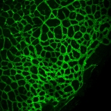 <h5>Anne-Eva van der Wijk</h5><p>Whole-mount staining of retina from a young mouse. Retinal vasculature was stained with an isolectin B4 probe and image was recorded using the confocal laser scanning microscope SP8 with a 20x objective. </p>