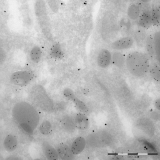 <h5>Anne van der Spek</h5><p>De EM figuur is een humane neutrofiel met een dubbel kleuring voor lactoferrine (10nm goud) en deiodinase type 3 (15nm goud). Het lactoferrine is een marker voor een type intracellulair granule in neutrofielen en je ziet hier ook mooi de granulaire labelling.</p>