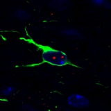 <h5>Maurik van Hal</h5><p>Confocal image of nuclear huntingtin aggregates in GFAP-positive astrocyte in a mouse brain section from the R6/2 mice - a model of Huntington’s disease.</p>