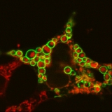 <h5>Rene Leen</h5><p>Endocytosis in a neuroblastoma cell line, Green: Rab7-GFP, Red: DQ-BSA.</p>