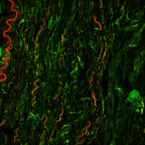 <h5>Samaneh Ghazanfari</h5><p>Fluorescent micrograph of a porcine carotid artery stained with elastin (red) and type I collagen (green).</p>