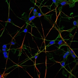 <h5>Nr. 3 - Maaike Commandeur</h5><p>Highly differentiated neuroblastoma cells, stained with phalloidin in green and the neuronal differentiation marker B-tubulin III in red and dapi in blue.</p>