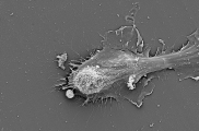 <h5>Nr. 2 - Marchien Dallinga</h5><p>SEM image of TIP Cell</p>